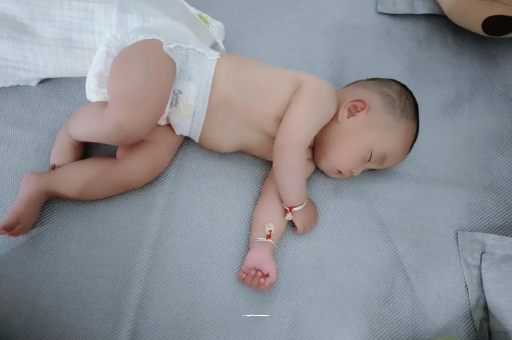 广州代怀试管生子宝宝褶皱处擦粉还是油